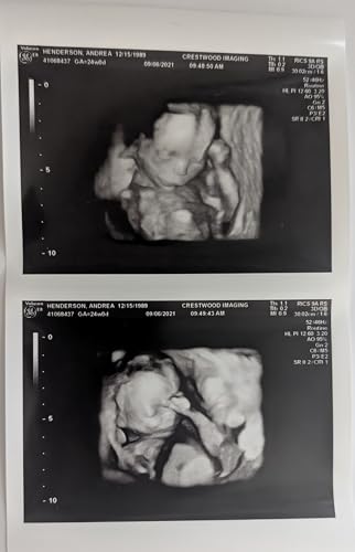 time for 3d ultrasound